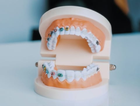 Orthodontics at Westmount Dental